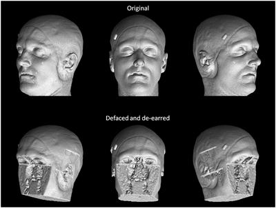 Multisite Comparison of MRI Defacing Software Across Multiple Cohorts